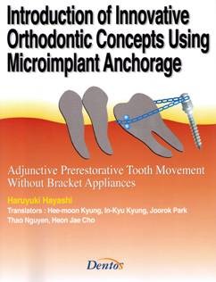 Introduction of Innovative Orthodontic Concepts Using Microinplant Anchorage