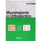 Microimplants in orthodontics