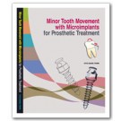 Minor tooth movement with Microimplants for prosthetic treatment